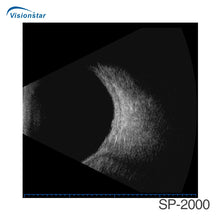 Load image into Gallery viewer, Sp-2000 China Eye Examination Portable Ultrasound Ab Scan Machine