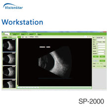 Load image into Gallery viewer, Sp-2000 China Eye Examination Portable Ultrasound Ab Scan Machine