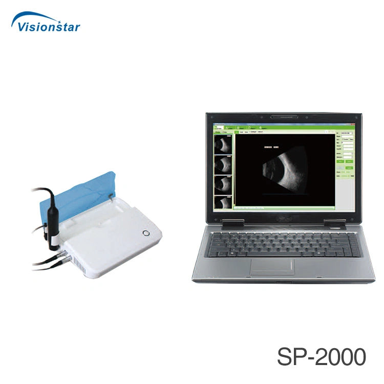 Sp-2000 China Eye Examination Portable Ultrasound Ab Scan Machine