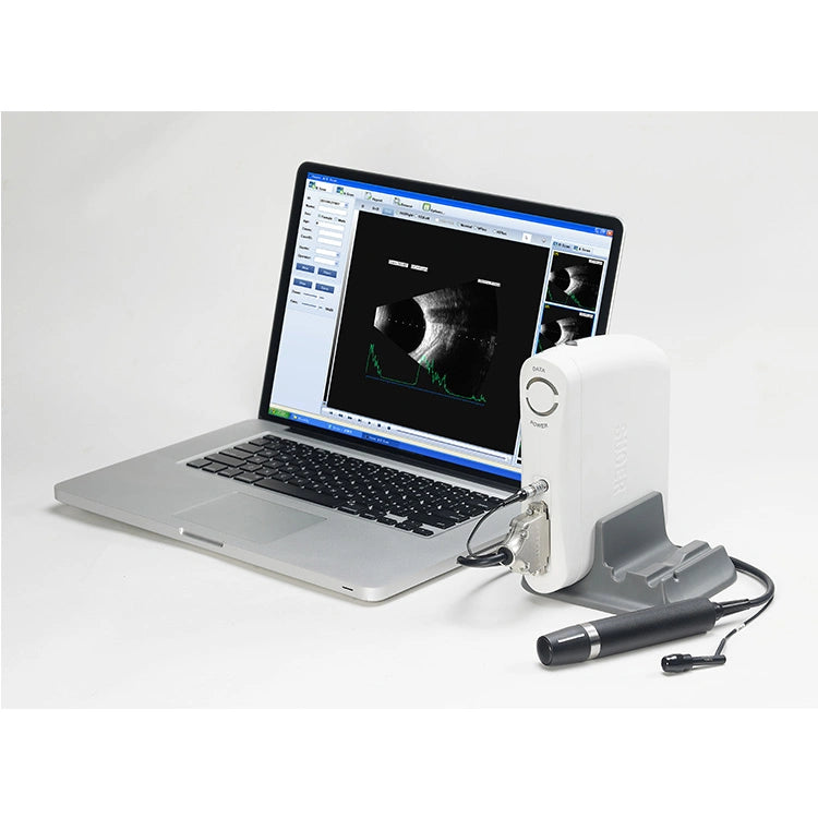 Sw-2100 Ophthalmic Ab Scan Ultrasound Device