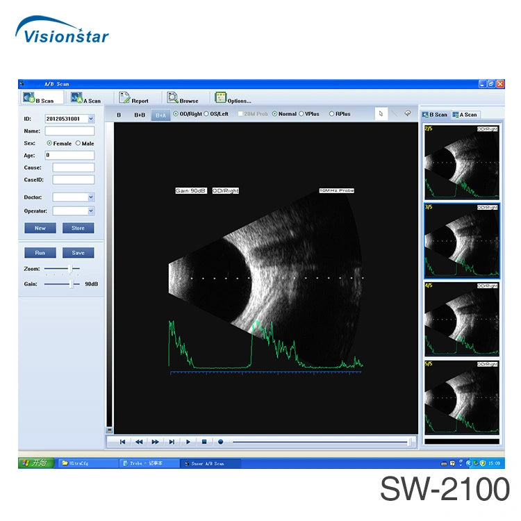 Sw-2100 Ophthalmic Ab Scan Ultrasound Device