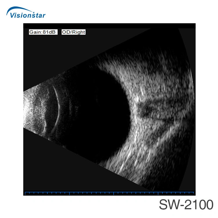 Sw-2100 Ophthalmic Ab Scan Ultrasound Device