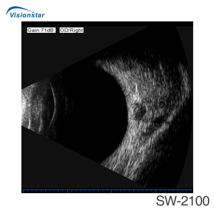 Sw-2100 Ophthalmic Ab Scan Ultrasound Device