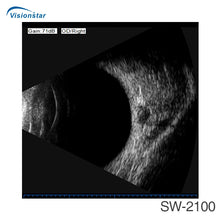Load image into Gallery viewer, Sw-2100 Ophthalmic Ab Scan Ultrasound Device