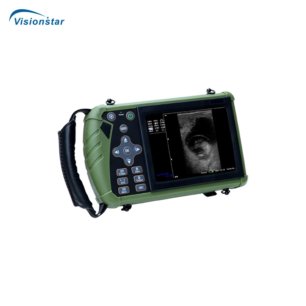 Veterinary Handheld Ultrasound Scanner Price, Palm Type Vet Ultrasound Dw-Vet6