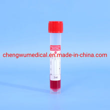 Load image into Gallery viewer, Virus Transport Medium with Nasal Swab and Oral Swab Vtm Tube