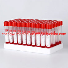 Load image into Gallery viewer, Virus Transport Medium with Nasal Swab and Oral Swab Vtm Tube