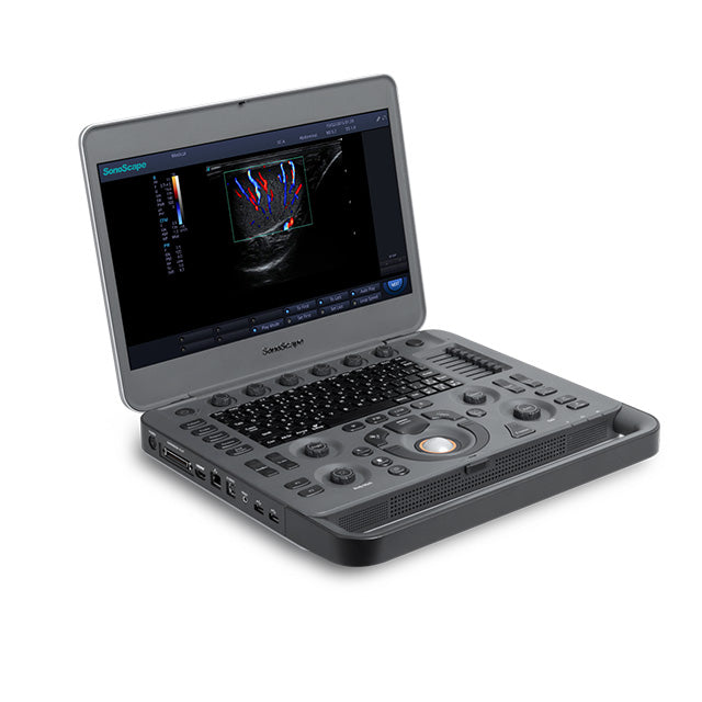 SONOSCAPE X5 Portable Color Doppler System OB / GYN Ultrasound