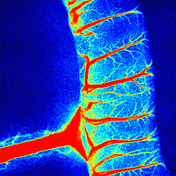 RFLSI Ⅲ Laser Speckle Imaging System