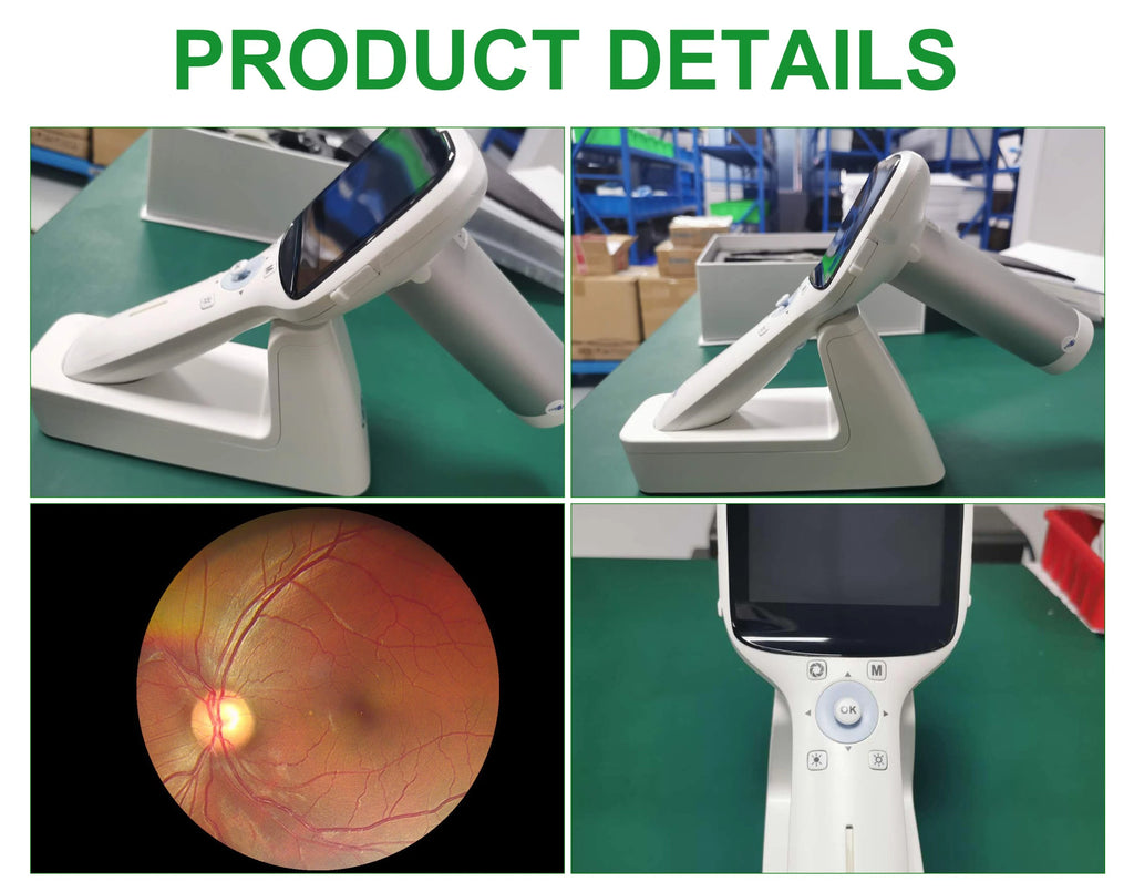 in-V042A Icen Digital Eye Retinal Ophthalmic Optical Equipment Fundus Camera Low Price